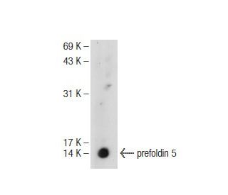 prefoldin 5 Antibody (E-9) - Western Blotting - Image 109122 