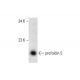 prefoldin 5 Antibody (G-2) - Western Blotting - Image 132745 