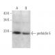 prefoldin 5 Antibody (G-2) - Western Blotting - Image 367657