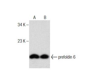 prefoldin 6 Antibody (F-11) - Western Blotting - Image 158443 