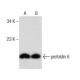 prefoldin 6 Antibody (F-11) - Western Blotting - Image 158443 