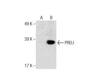 PRELI Antibody (H-7) - Western Blotting - Image 286864