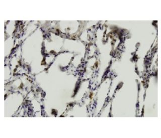 PRELI Antibody (QF-7) - Immunohistochemistry - Image 36175 