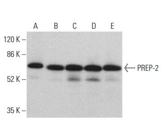 PREP-2 Antibody (56.1) - Western Blotting - Image 376706 