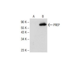 PREP Antibody (C-12) - Western Blotting - Image 141298Each CRISPR/Cas9 Knockout (KO) Plasmid product consists of a pool of 3 plasmids designed to ensure identification and cleavage of a specific gene for maximum knockout efficiency. Each plasmid encodes a unique 20 nt sequence derived from the GeCKO (v2) library.
