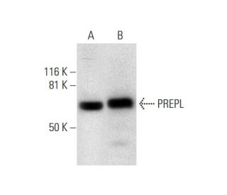 PREPL Antibody (E-9) - Western Blotting - Image 294599 