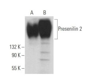 western blotting image from recommended Presenilin 2 (B-7) monoclonal antibody replacement. Image 369814