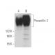 western blotting image from recommended Presenilin 2 (B-7) monoclonal antibody replacement. Image 369814