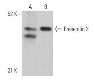 Presenilin 2 Antibody (B-7) - Western Blotting - Image 362213 