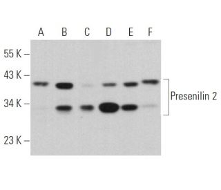Presenilin 2 Antibody (B-7) - Western Blotting - Image 368436Each CRISPR/Cas9 Knockout (KO) Plasmid product consists of a pool of 3 plasmids designed to ensure identification and cleavage of a specific gene for maximum knockout efficiency. Each plasmid encodes a unique 20 nt sequence derived from the GeCKO (v2) library. 