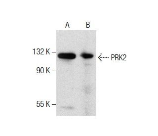 PRK2 Antibody (A-3): sc-271971