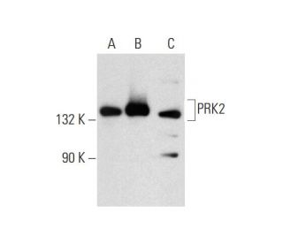 PRK2 Antibody (C-6) - Western Blotting - Image 138493 