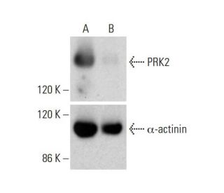 PRK2 CRISPR/CAS9 KO Plasmid (h): sc-407649. Western blot analysis of PRK2 expression in empty vector control (A) and PRK2Each CRISPR/Cas9 Knockout (KO) Plasmid product consists of a pool of 3 plasmids designed to ensure identification and cleavage of a specific gene for maximum knockout efficiency. Each plasmid encodes a unique 20 nt sequence derived from the GeCKO (v2) library.
