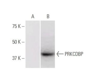 PRKCDBP Antibody (8D3) - Western Blotting - Image 347634 