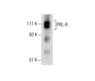 PRL-R Antibody (B10) - Western Blotting - Image 285209 