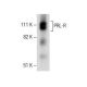 PRL-R Antibody (B10) - Western Blotting - Image 285209 