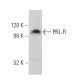 PRL-R Antibody (B10) - Western Blotting - Image 359660