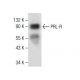 Dieser polyklonale Antikörper wird nicht mehr hergestellt. Wir empfehlen Ihnen unseren <a href="prl-r-antibody-d-7">PRL-R (D-7)</a> monoklonalen Antikörper (Beispielsdaten werden angezeigt). western blotting image from recommended PRL-R (D-7) monoclonal antibody replacement. Image 281633