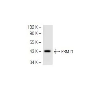 PRMT1 Antibody (PRMT1-171) - Western Blotting - Image 46593 