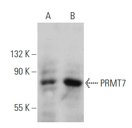 Anti-PRMT7 Antibody (F-2) | SCBT - Santa Cruz Biotechnology