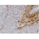 immunohistochemistry image from recommended COL1A1 (3G3) monoclonal antibody replacement. Image 346114