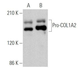 western blotting image from recommended Pro-COL1A2 (D-6) monoclonal antibody replacement. Image 369268