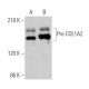 이 다클론 항체는 생산이 중단되었습니다. 권장 <a href="pro-col1a2-antibody-d-6">Pro-COL1A2 (D-6)</a> 단클론 항체(샘플 데이터 표시)를 참조하세요. western blotting image from recommended Pro-COL1A2 (D-6) monoclonal antibody replacement. Image 369268