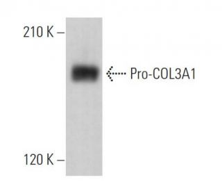Pro-COL3A1 Antibody (A-1) - Western Blotting - Image 374333 