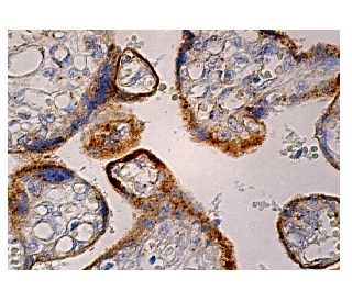 immunohistochemistry image from recommended Pro-COL3A1 (B-4) monoclonal antibody replacement. Image 158890