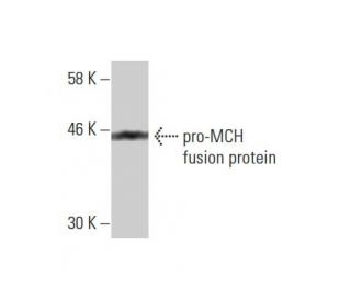 western blotting image from recommended pro-MCH (1D1) monoclonal antibody replacement. Image 348569