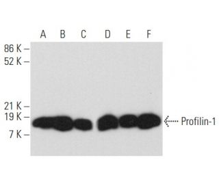 western blotting image from recommended Profilin-1 (B-10) monoclonal antibody replacement. Image 358078