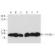 western blotting image from recommended Profilin-1 (B-10) monoclonal antibody replacement. Image 358078