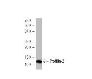 Profilin-2 Antibody (4K-6) | SCBT - Santa Cruz Biotechnology