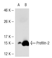 Profilin-2 Antibody (4K-6): sc-100955