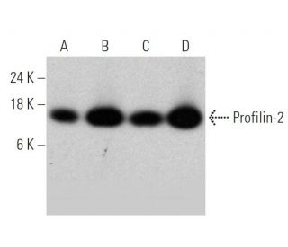 Profilin-2 Antibody (4K-6) - Western Blotting - Image 368251 