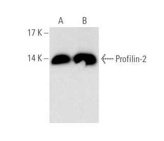 Profilin-2 Antibody (4K-6) - Western Blotting - Image 65727
