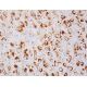 Progesterone Antibody (11P14) - Immunohistochemistry - Image 392229