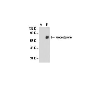 Progesterone Antibody (11P14) - Western Blotting - Image 18089 