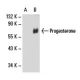 Progesterone Antibody (11P14) - Western Blotting - Image 18089 