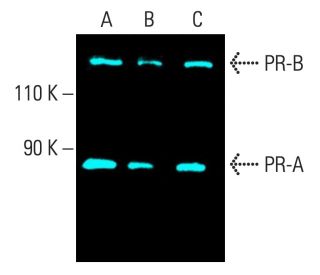 Progesterone Receptor Antibody (A-2) - Western Blotting - Image 402178Each CRISPR/Cas9 Knockout (KO) Plasmid product consists of a pool of 3 plasmids designed to ensure identification and cleavage of a specific gene for maximum knockout efficiency. Each plasmid encodes a unique 20 nt sequence derived from the GeCKO (v2) library.