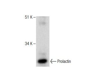 western blotting image from recommended Prolactin (A-7) monoclonal antibody replacement. Image 281183