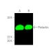 This polyclonal antibody has been discontinued. See our recommended <a href="prolactin-antibody-h-12">Prolactin (H-12)</a> monoclonal antibody (sample data shown). western blotting image from recommended Prolactin (H-12) monoclonal antibody replacement. Image 389735