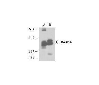 Prolactin Antibody (PRL-149L II) - Western Blotting - Image 15683 