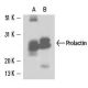 Prolactin Antibody (PRL-149L II) - Western Blotting - Image 15683 