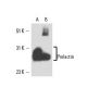 Prolactin Antibody (PRL-149L II) - Western Blotting - Image 16381 