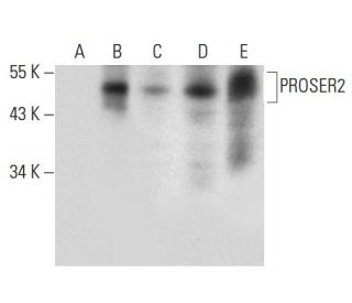 PROSER2 Antibody (E-7) - Western Blotting - Image 311971