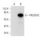 PROSER2 Antibody (G-11) - Western Blotting - Image 314489