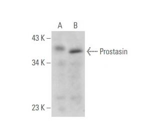 Prostasin Antibody (C-10) - Western Blotting - Image 333665
