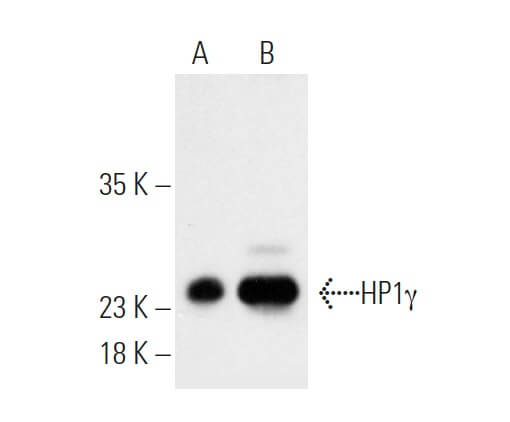 Protein A-Agarose | SCBT - Santa Cruz Biotechnology