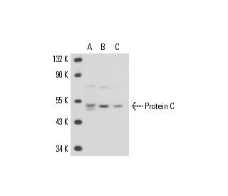 Protein C Antibody (HLW-C) - Western Blotting - Image 17119 